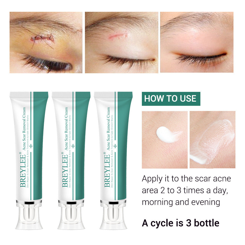 DERMASCAR SOOTHING CREAM